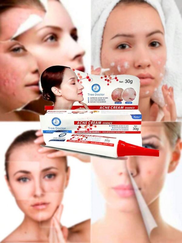 Tree Doctor Acne Treatment Cream 30g – Fast-Acting Anti-Acne & Repair Formula