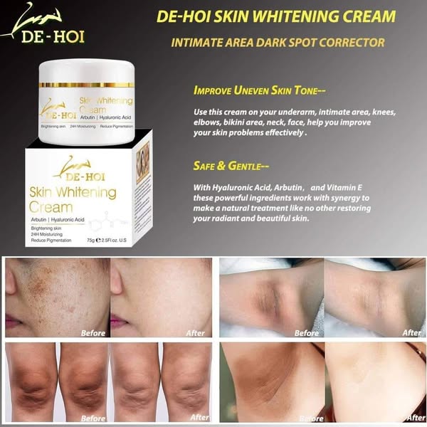 De Hoi Whitening Cream – Brightening & Moisturizing Face & Body Cream – 75g