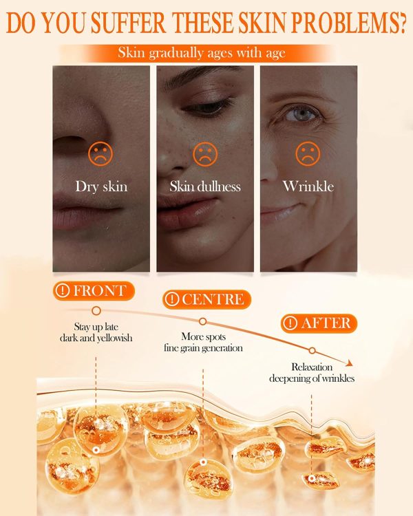 Sadoer 5x Vitamin C Whitening Cream – Hydrating & Repairing Moisturizer 50g