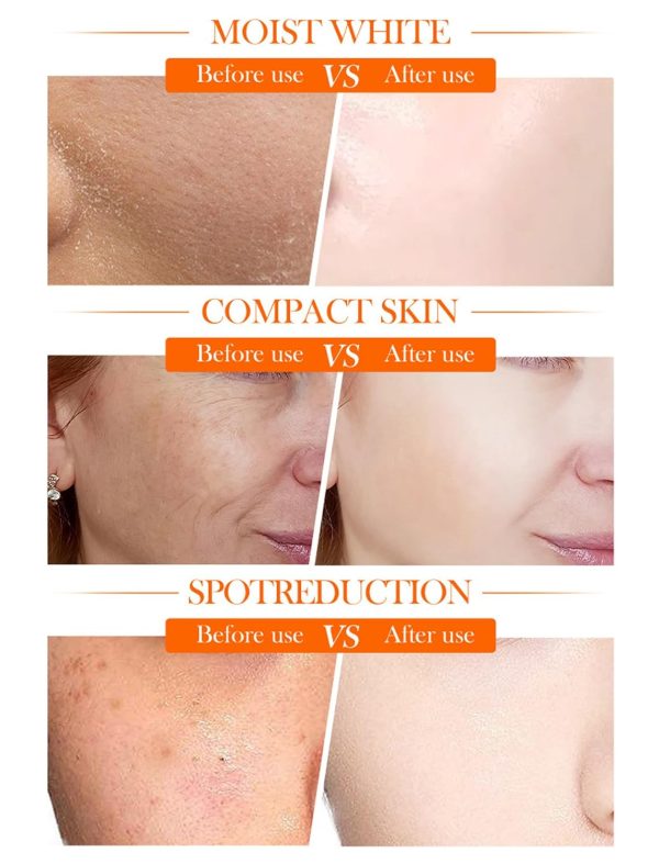 Sadoer 5x Vitamin C Whitening Cream – Hydrating & Repairing Moisturizer 50g