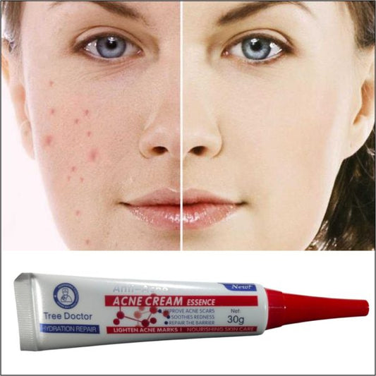 Tree Doctor Acne Treatment Cream 30g – Fast-Acting Anti-Acne & Repair Formula
